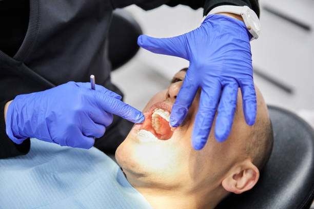 Best Broken or Cracked Tooth Emergency Dentist in Copiague, NY